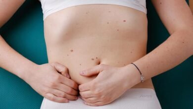 lymphödem bauch bilder